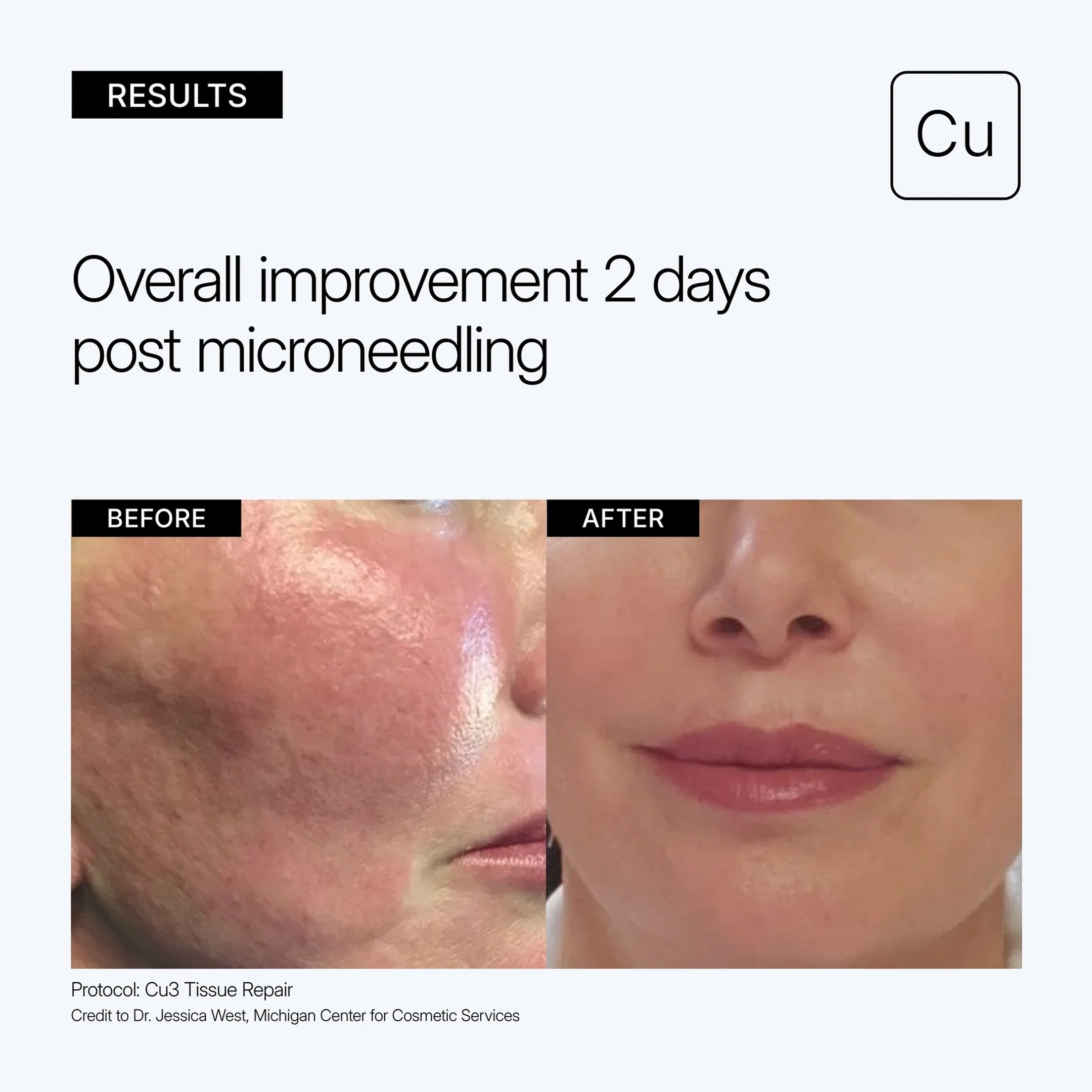 Neova Cu3 Tissue Repair – La Suite Skincare
