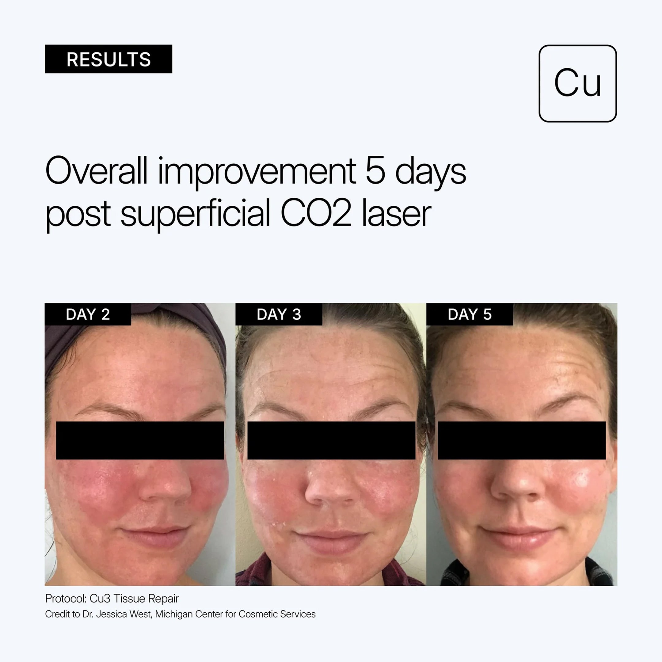 Neova CU3 Tissue Repair – La Suite Skincare