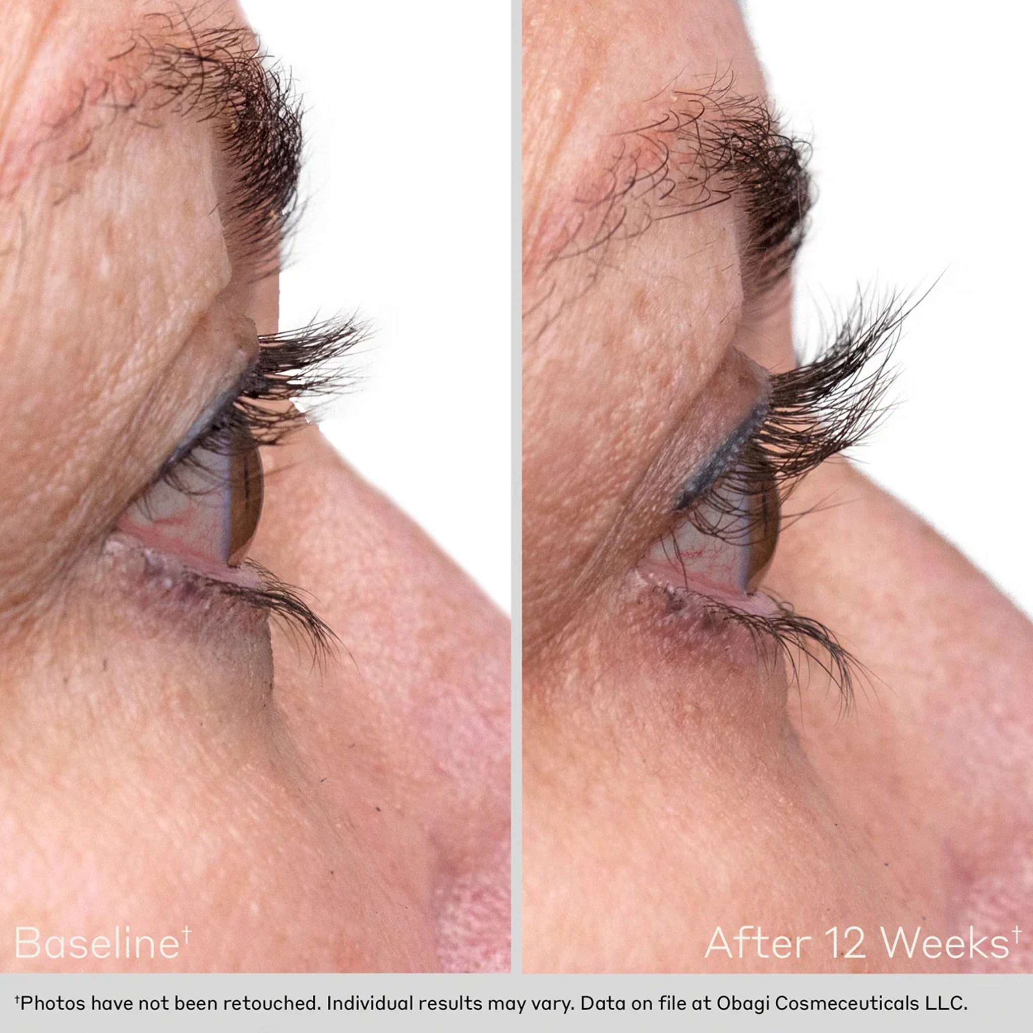 Obagi Nu-Cil® Eyelash Enhancing Serum – La Suite Skincare