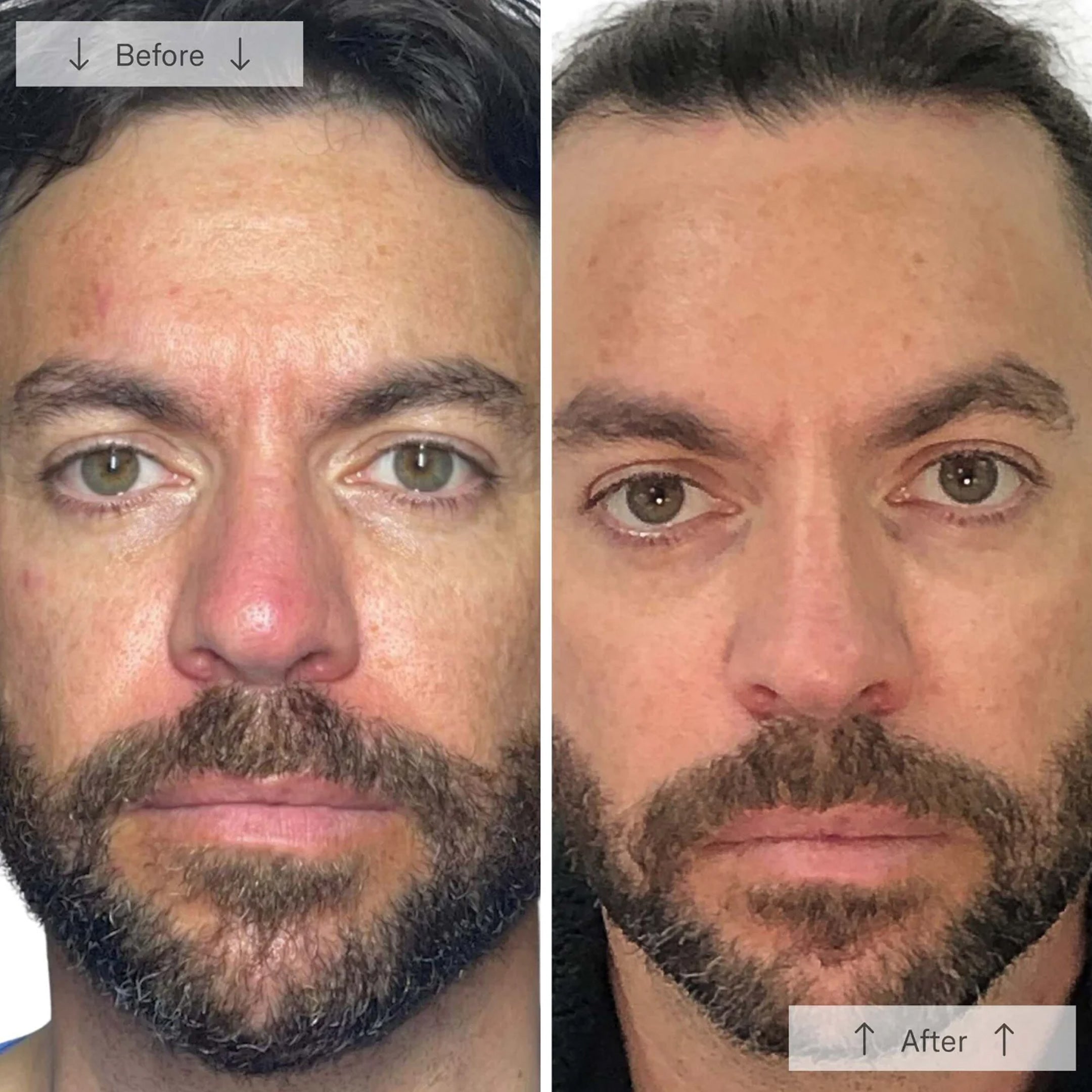 Omnilux Men – La Suite Skincare