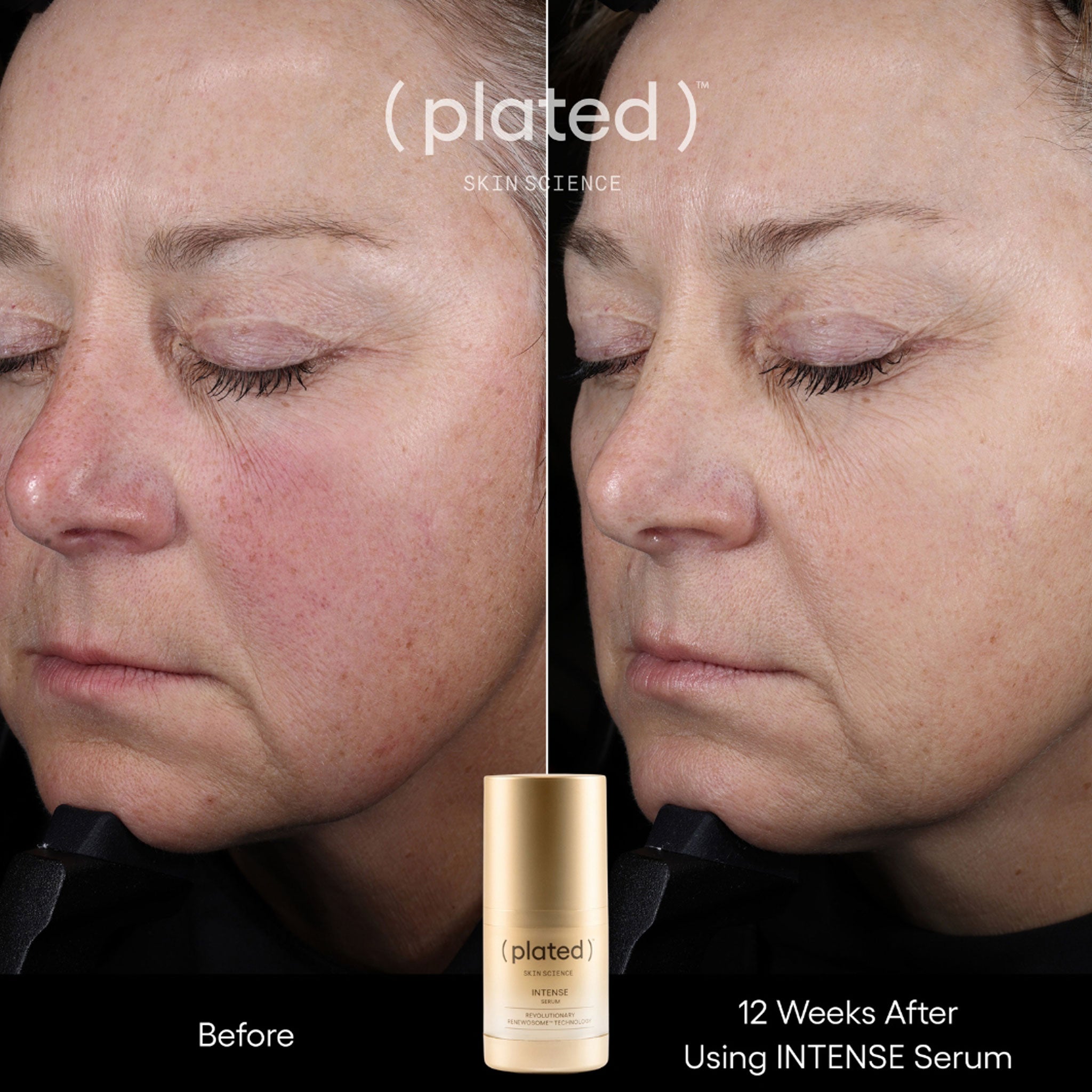 plated)™ INTENSE Serum – La Suite Skincare